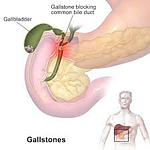 Bladder graphic